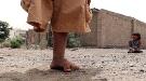 مسؤول محلي يدحض آلة التضليل الحوثية عن ضحايا الألغام في الحديدة ...