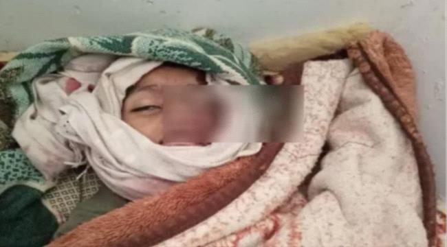  طفل يفقد حياته دهسًا أثناء سعيه للحصول على 5 لتر ماء في تعز ...