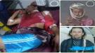 الكشف عن احد المتورطين بمحاولة اغتيال شاب معاق ونهب دراجته غرب تعز و مناشدات لتسليم الجاني...