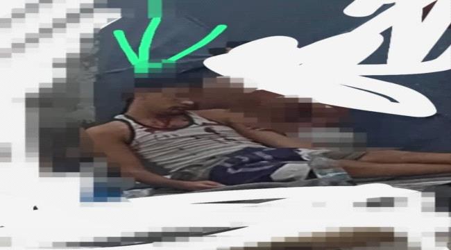 منذ 5 أشهر .. مالك الصبري يتقي دمًا ويناشد السماح له بالعلاج قبل أن يلفظ أنفاسه الأخيرة داخل سجن تعز ...