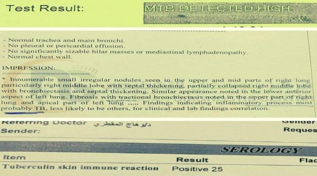 صنعاء: الكشف عن حالة 