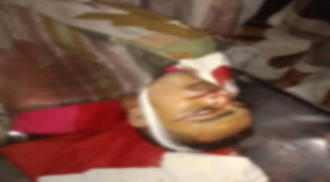 مقتل شاب برصاص عنصر حوثي يثير غضباً شعبياً في سامع بتعز ...