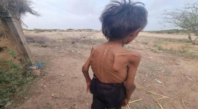 مليشيا الحوثي تدّخر الغذاء.. وتترك اليمنيين فريسة للمجاعة ...