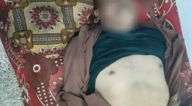وفاة مواطن إثر صاعقة رعدية في مديرية وصاب السافل بذمار ...