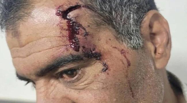 ذمار: مليشيا الحوثي تعتدي على أحد عقال الأحياء وتثير موجة استياء واسعة ...